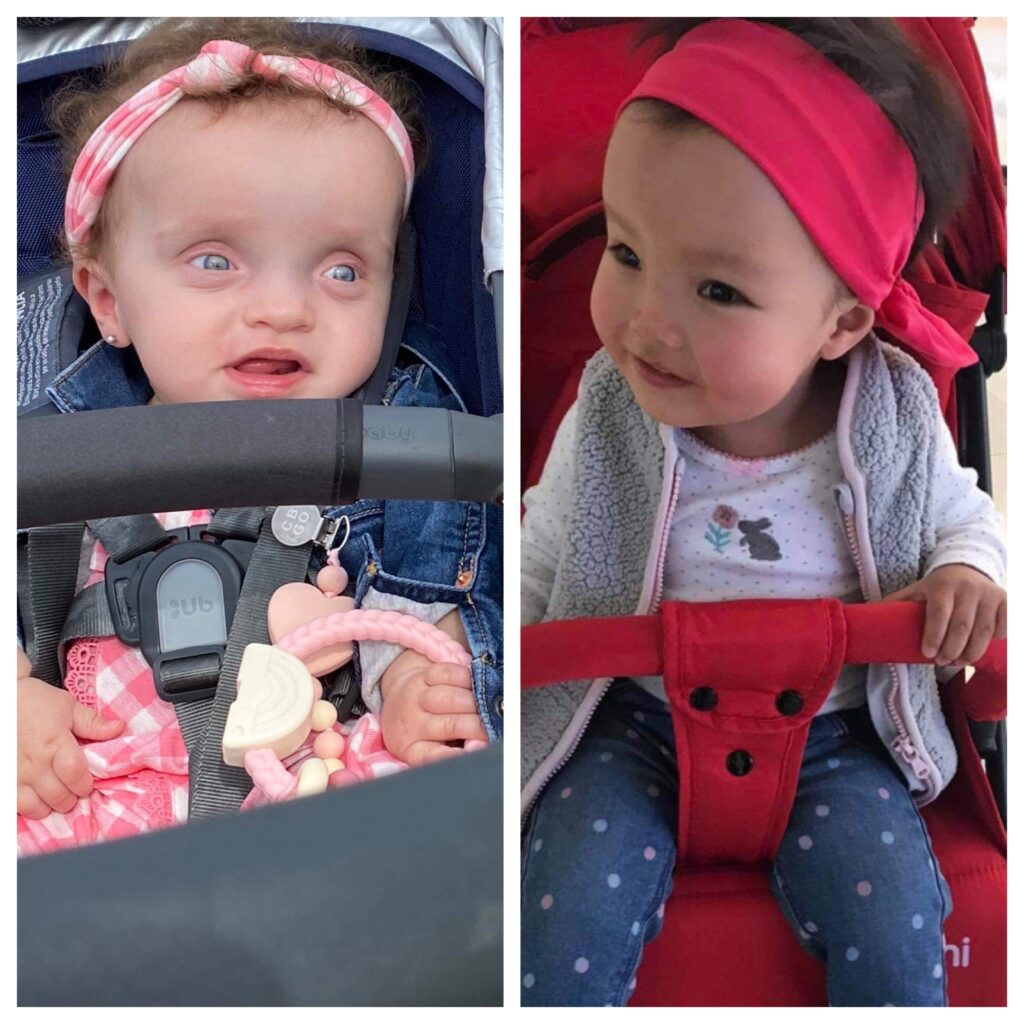 two baby girls with Jordan's Syndrome